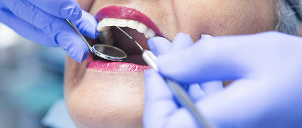 Best Emergency Dental Care for Broken or Chipped Teeth in Glide, OR
